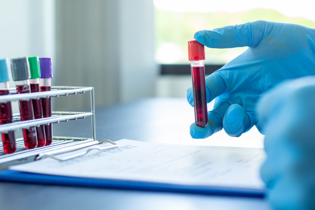 Blood test tubes. female scientist or a doctor examining blood test tubes at her laboratory DNA testing analysis profession specialist clinician experienced medicine healthcare doctor concept