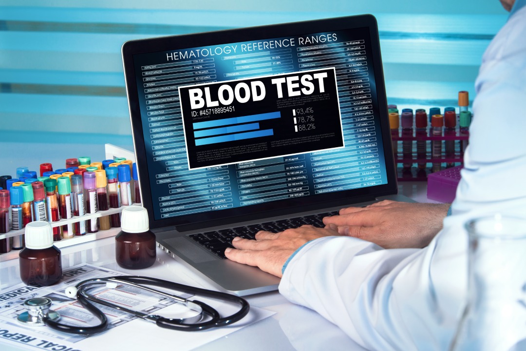 médico con muestras de sangre para su análisis con software de resultados de análisis en el laboratorio/ Análisis de sangre. médico en el laboratorio examinando los resultados de la muestra de sangre en el ordenador